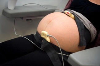 monitoreo fetal