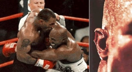 Tyson vs Holyfield despega un trozo de cartílago